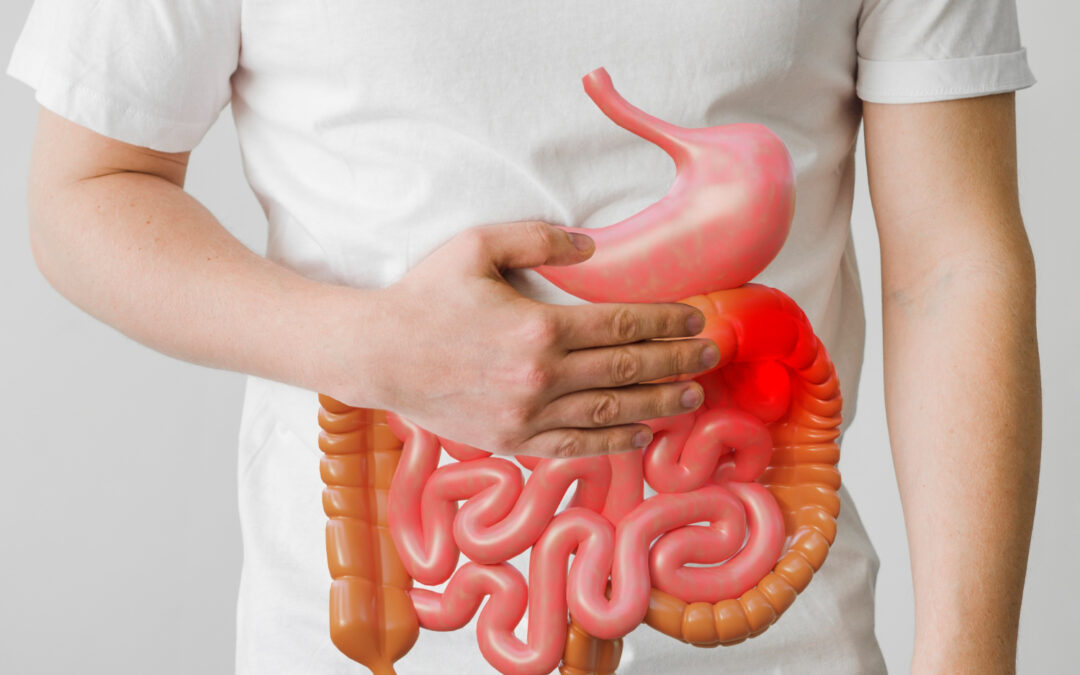 Unmasking Colon Cancer: Causes, Symptoms, and Strategies for Prevention